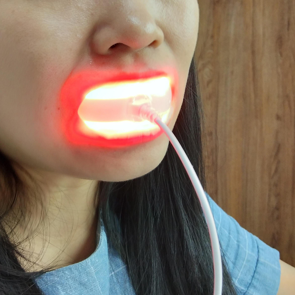 Clinic Red Laser Oral Therapy  - огляд і ціна Healing Wellness